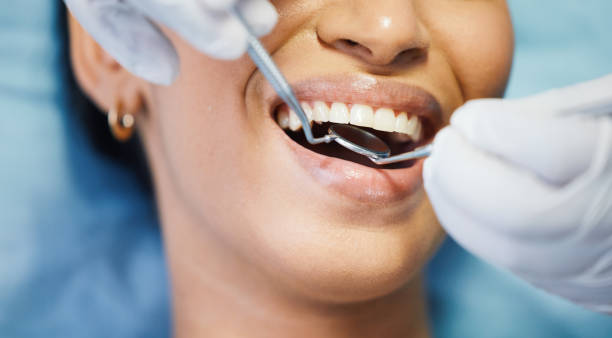 Best Emergency Dental Care for Broken or Chipped Teeth in Herington, KS