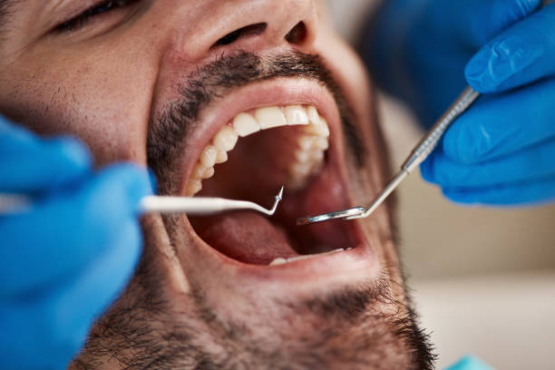 Best Emergency Denture Repair in Herington, KS